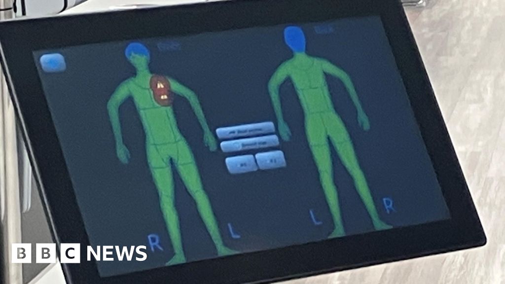 Airport Breast Form Pat-Down Stirs Outrage